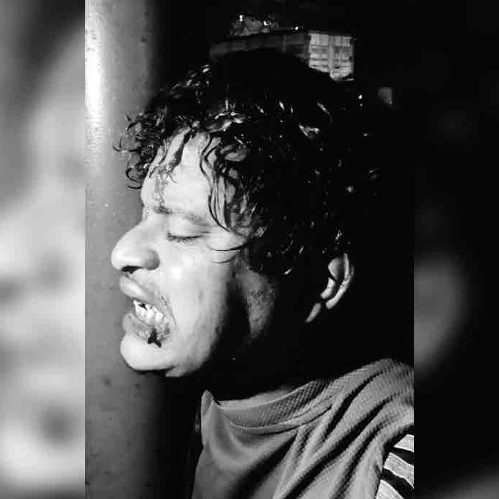 कानपुर में फर्नीचर कारीगर पर चापड़ से जानलेवा हमला:5 साथियों ने लाठी-डंडों से पीटा; सिर में 17 टांके लगे, आग में फेंका