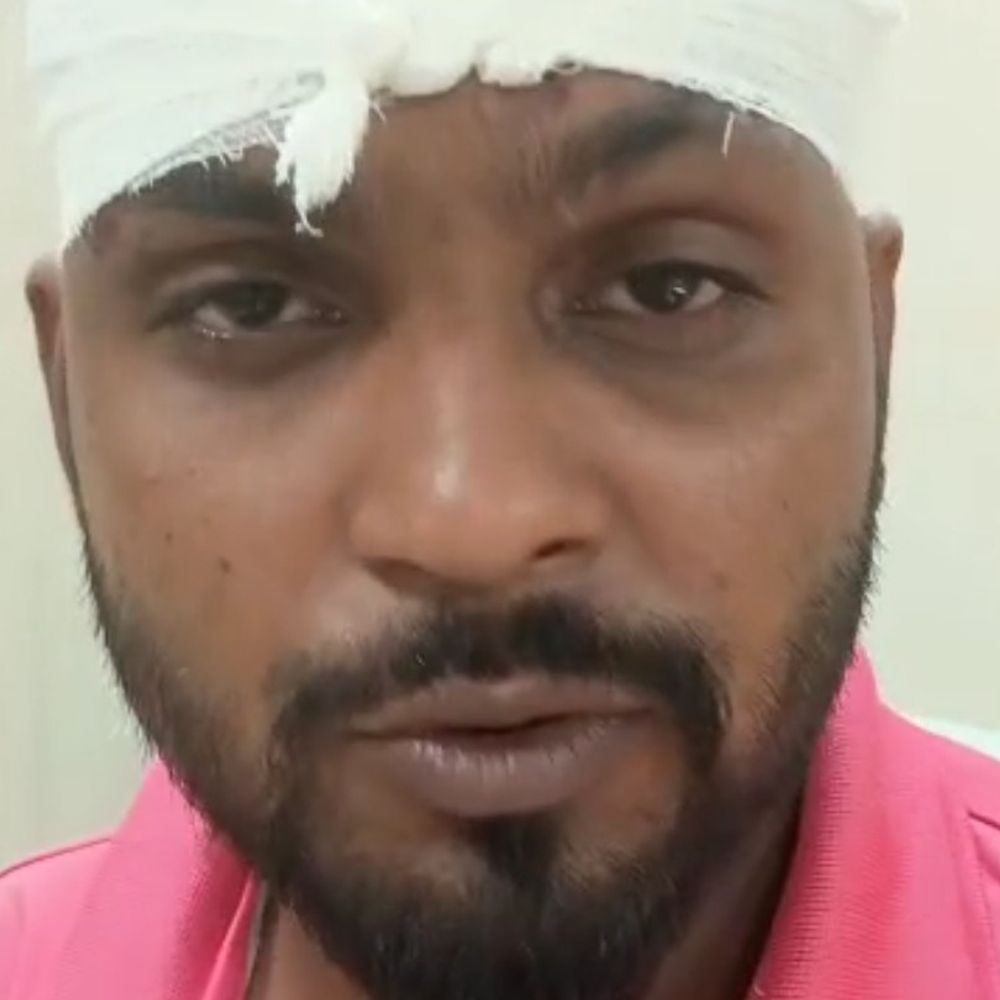 छात्रा से बदसलूकी का विरोध करने पर युवक पर हमला:बेल्ट से पीटा, सिर फूटा; गंभीर हालत में मेडिकल कॉलेज में कराया भर्ती