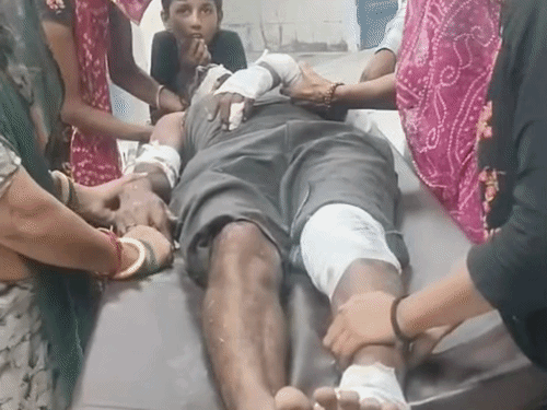 घोड़ा सामने आने से बाइक फिसली:युवक घायल, गंभीर हालत में पाली रेफर किया
