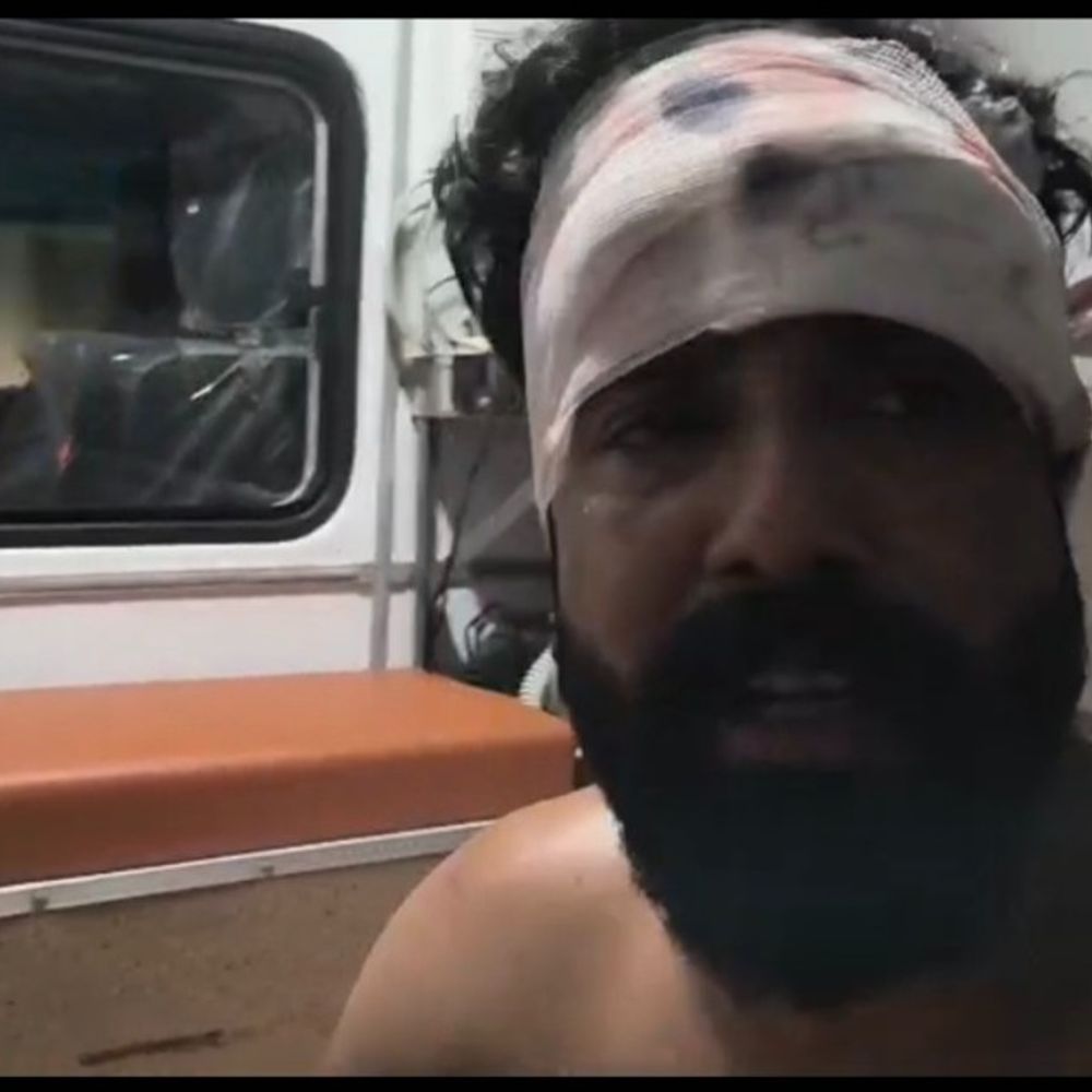 मुरैना में पुरानी रंजिश में युवक को गोली मारी:गुफा मंदिर के पास वारदात के बाद दो आरोपी फरार, जिला अस्पताल से ग्वालियर रेफर