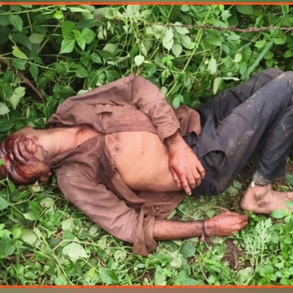 शाजापुर में युवक से मारपीट:, सिर में गंभीर चोटें, 5 हजार की उधारी को लेकर हुआ था विवाद