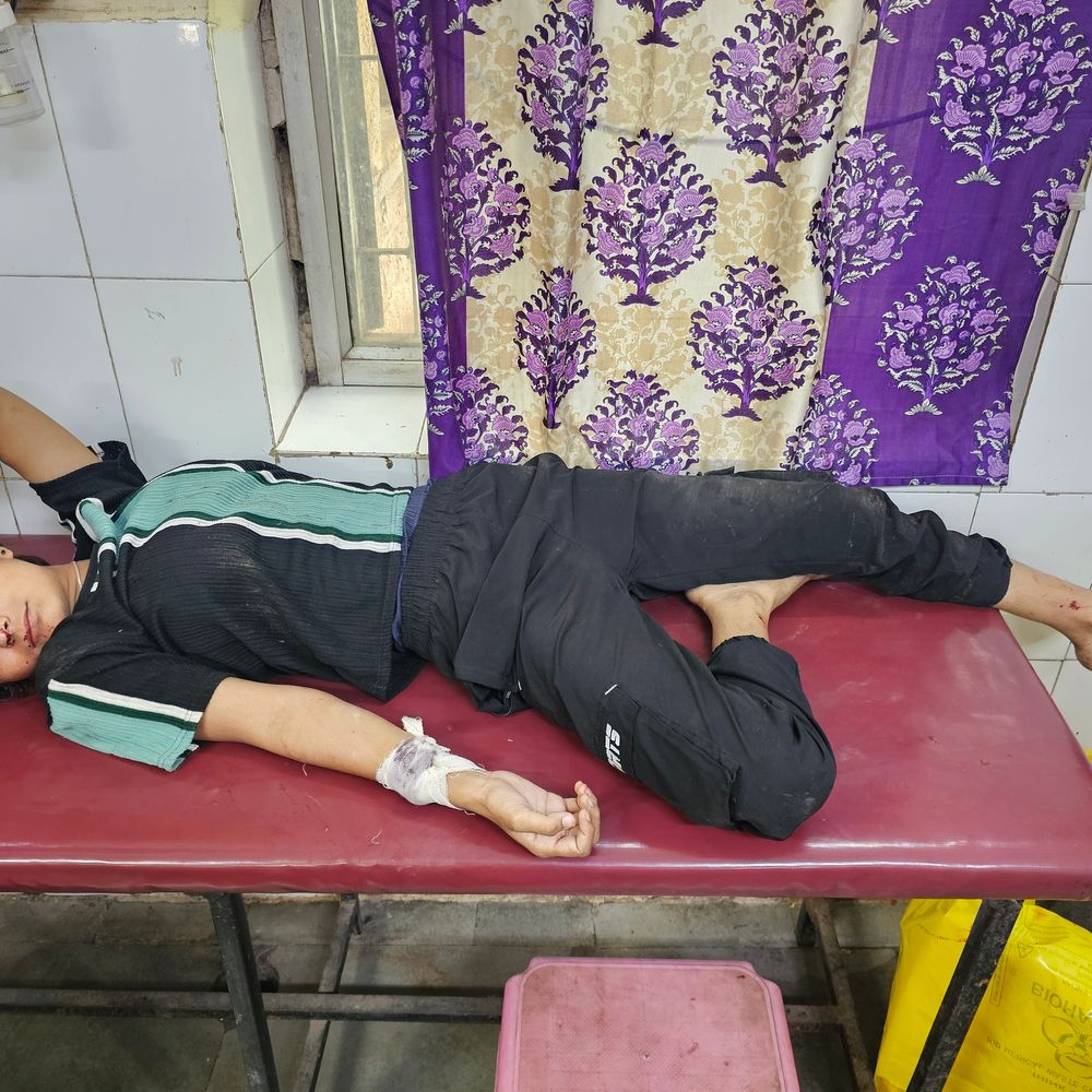 
                 मंदसौर में स्कॉर्पियो ने बाइक को मारी टक्कर, पिता-पुत्री घायल:किराने का सामान लेने जा रहे थे; पिता उदयपुर रेफर 
            