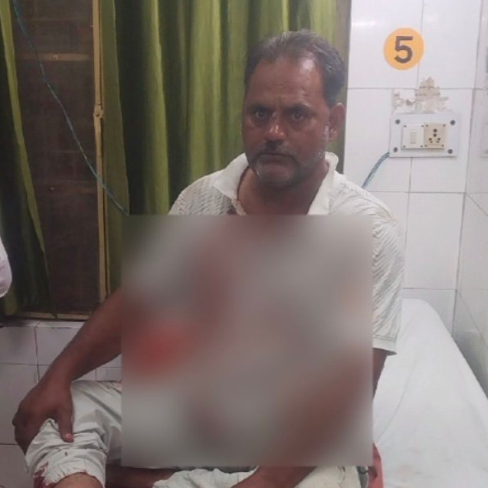 ललितपुर में दबंगों ने पिता-पुत्र सहित तीन को पीटा:अपहरण कर भैंस चोरी का झूठा VIDEO बनवाया, बंदूक से फायरिंग का भी आरोप