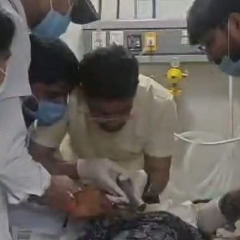सांस की नली में फंसा प्लास्टिक, CPR से बची जान:लखनऊ में डॉक्टरों ने सक्शन मशीन से निकाला, फेफड़ों से दाल का पानी भी साफ किया