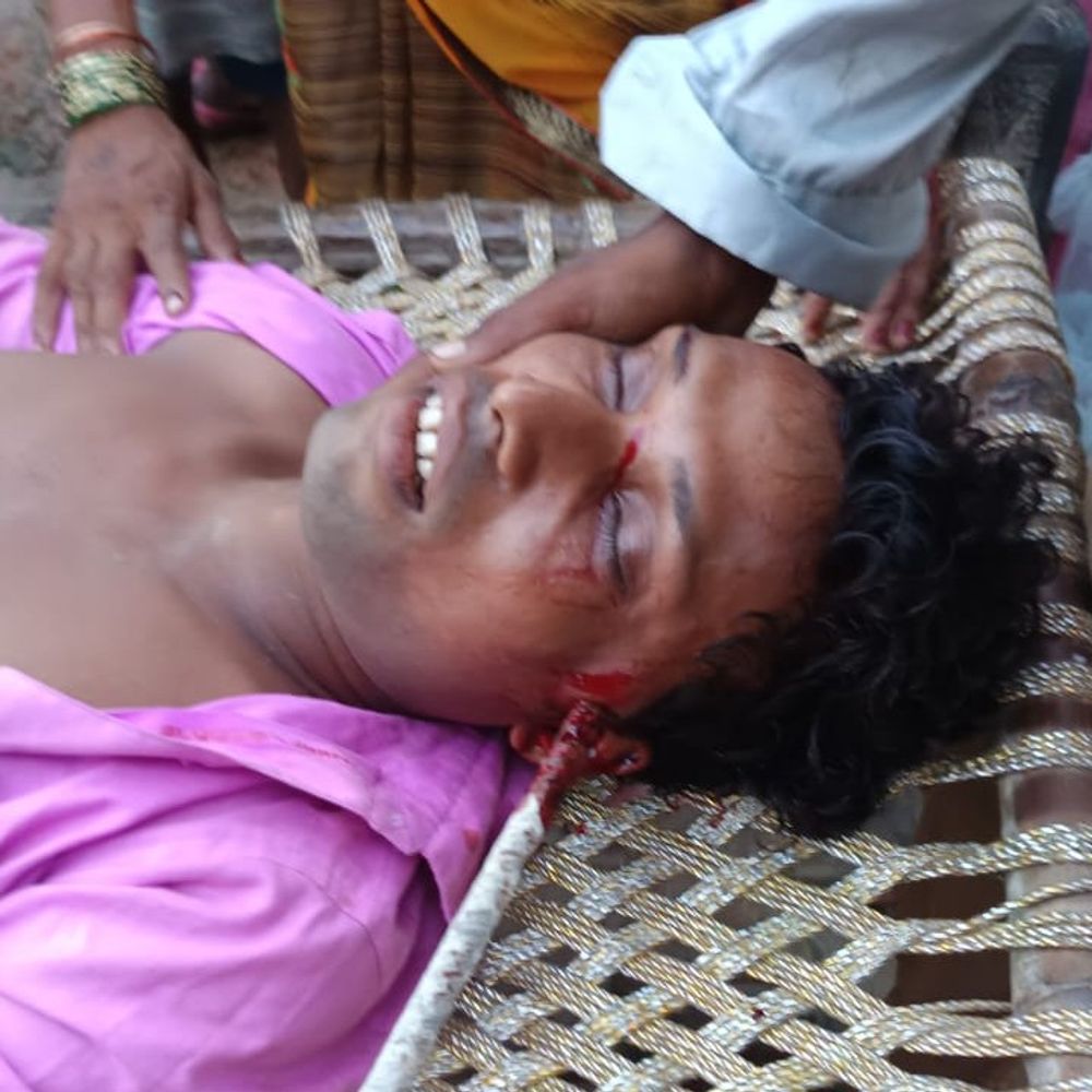 संभल में कान में सरिया घुसने से युवक की मौत:बच्चों के पुराने विवाद में चचेरे भाइयों में मारपीट-पथराव; बुलंदशहर में 2 घंटे चला ऑपरेशन