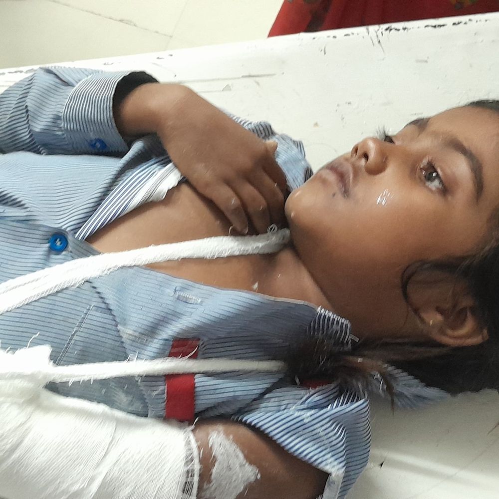 क्षमता से ज्यादा बच्चे वैन में भरने पर पलटी:भिंड में लोडिंग सामने आते ही बिगड़ा संतुलन; एक लड़की का हाथ फ्रैक्चर
