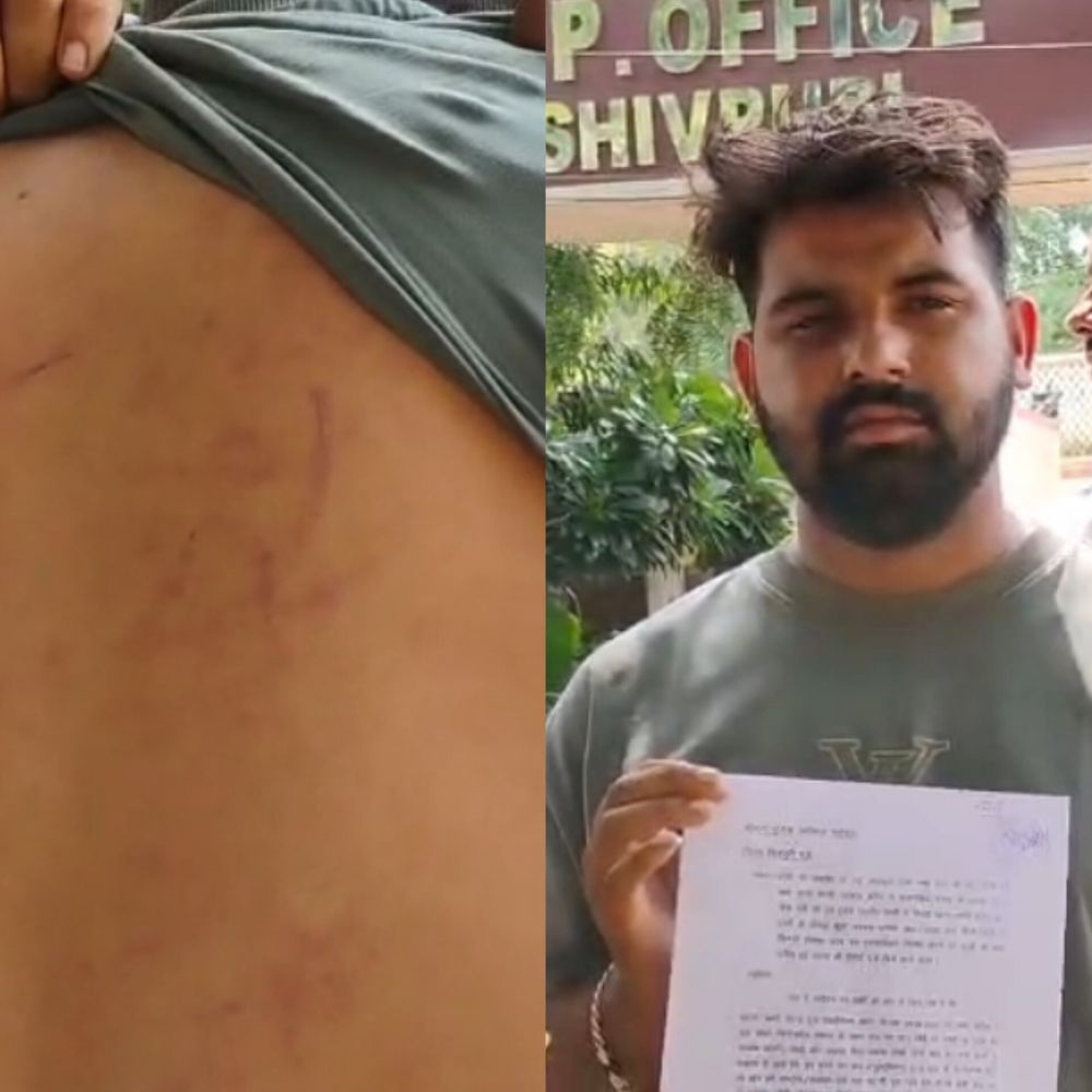 शिवपुरी में राशन वितरण विवाद:  युवक ने सरपंच समेत 5 लोगों पर मारपीट का लगाया, पुलिस पर कार्रवाई न करने की शिकायत एसपी से की – Shivpuri News