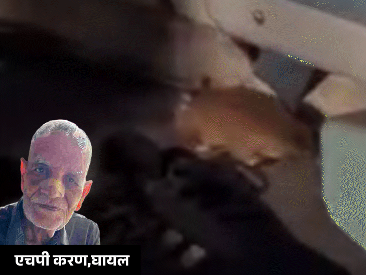 फर्स्ट AC में चूहे ने पैसेंजर की नाक काटी:ऊना-इंदौर एक्सप्रेस में मची चीख-पुकार, शिकायत के बाद भी नहीं पकड़ा; रेबीज इंजेक्शन लगवाना पड़ा