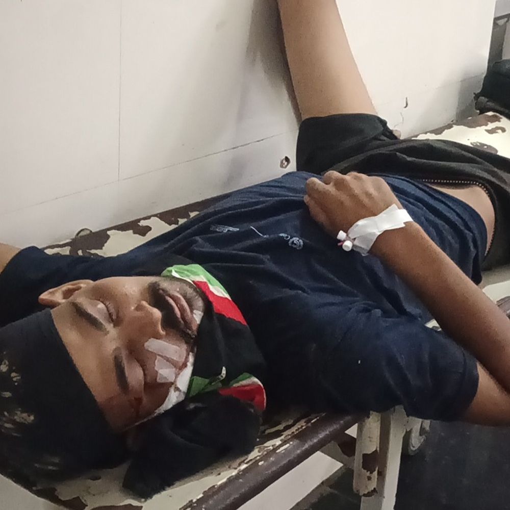 पुरंदरपुर थाना के पास अनियंत्रित बाइक से गिरा युवक:गंभीर हालत में महराजगंज जिला अस्पताल में इलाज जारी
