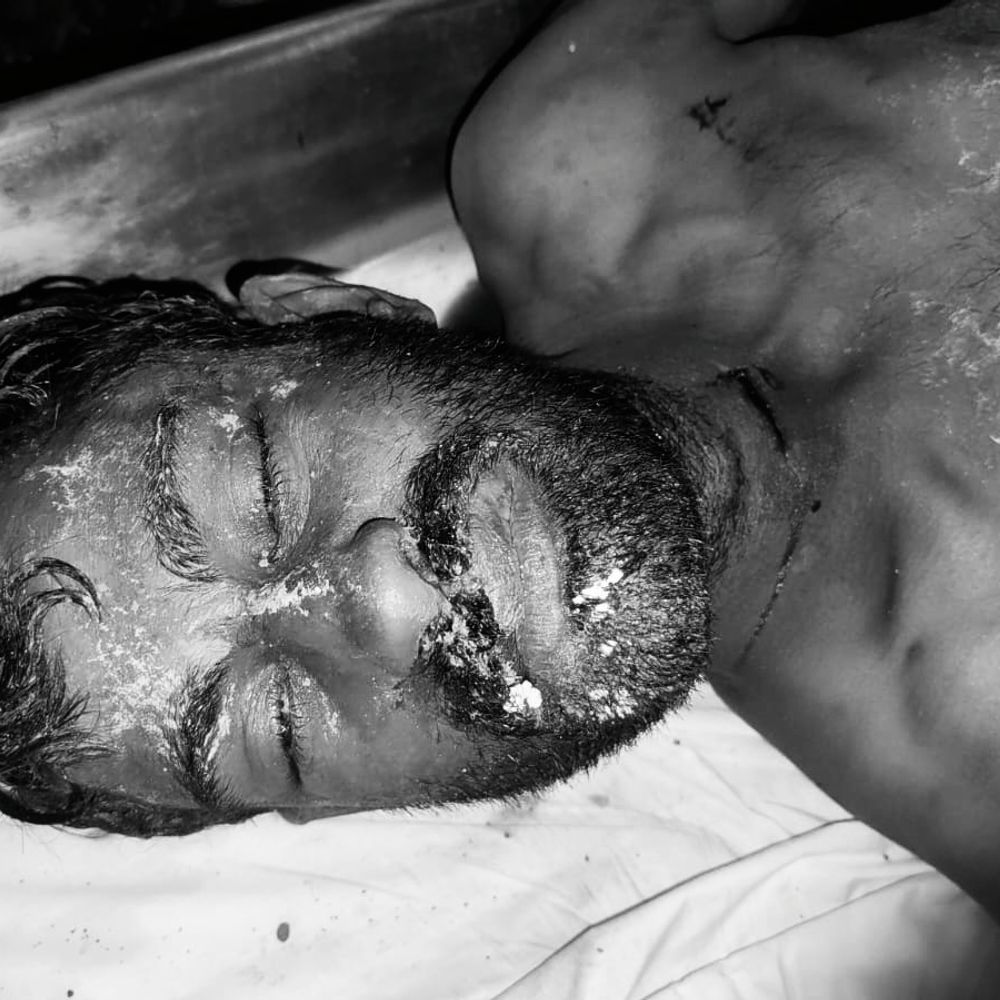 खेत में मिली अज्ञात युवक की लाश, हत्या कर फेंका:शिवपुरी में शराब गोदाम के पीछे शव मिला, पुलिस को हत्या कहीं और कर शव फेंकने का शक