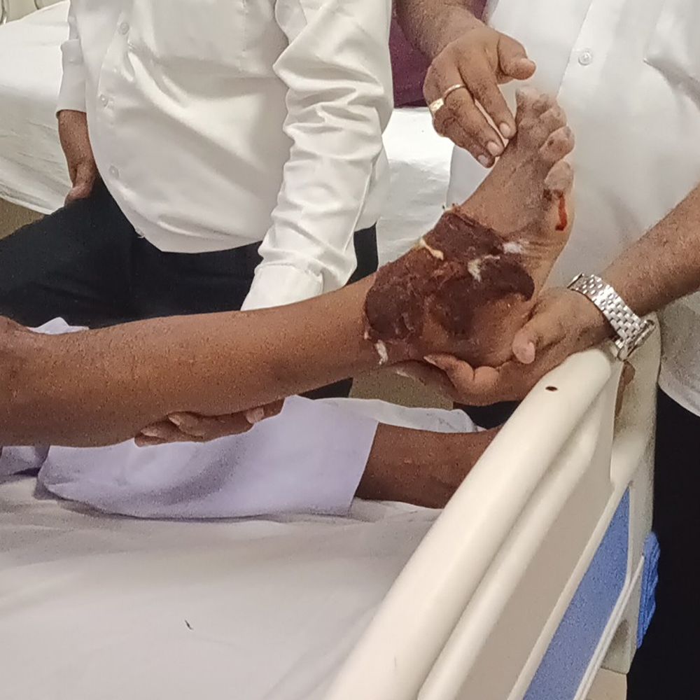 बैकुंठपुर में तेज रफ्तार वाहन की टक्कर:बाइक सवार दंपती गंभीर रूप से घायल, अस्पताल में भर्ती