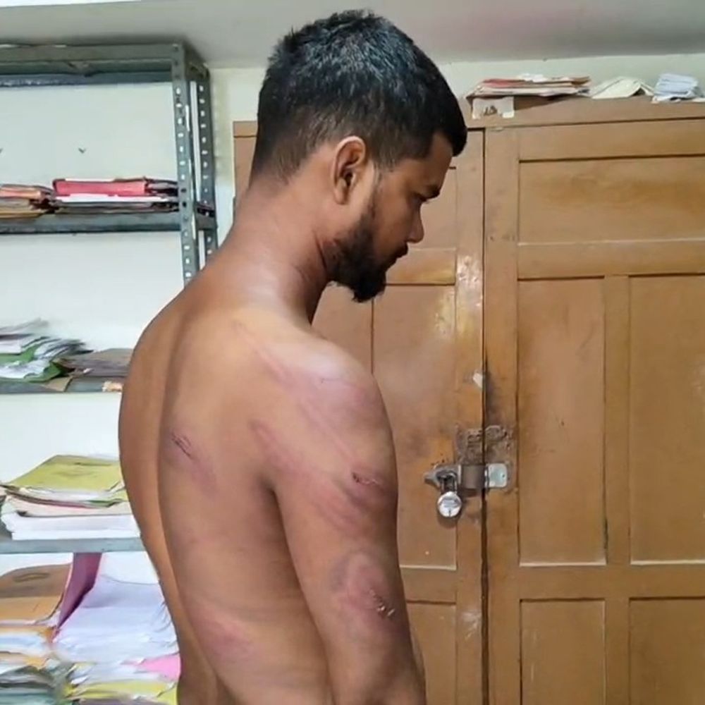 खान इंस्पेक्टर पर मारपीट और पैसे छीनने का आरोप:घायल ट्रक ड्राइवर का वीडियो वायरल, खनन विभाग ने 9 लाख रुपए का जुर्माना लगाया