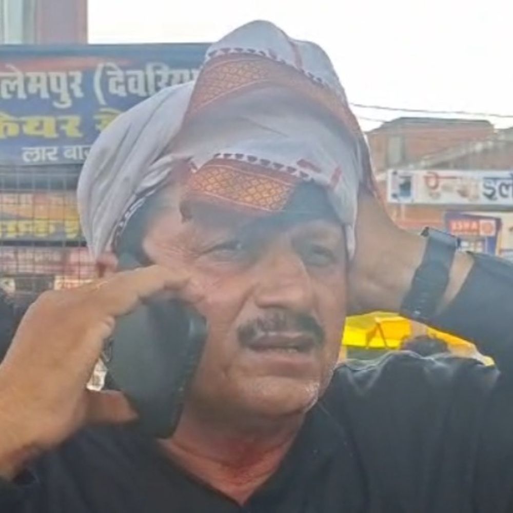 ठेला हटाने के विवाद में युवक पर चाकू से हमला:देवरिया के गांधी चौक पर दिनदहाड़े हुई घटना, आरोपी फरार