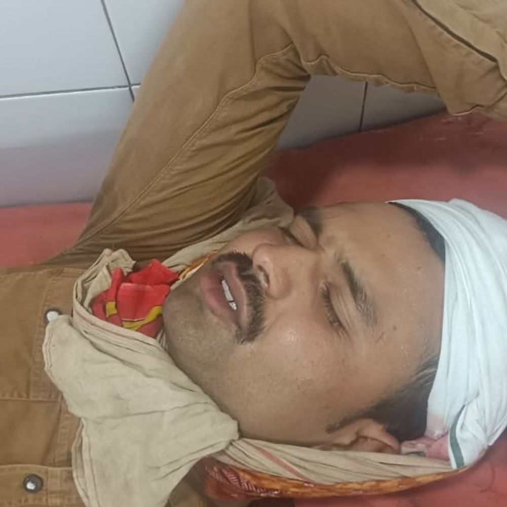 अवैध शराब की सूचना पर आबकारी टीम पर हमला:दो सिपाही घायल, लाठी-डंडों और रॉड से पीटा; 5 नामजद समेत अज्ञात पर केस