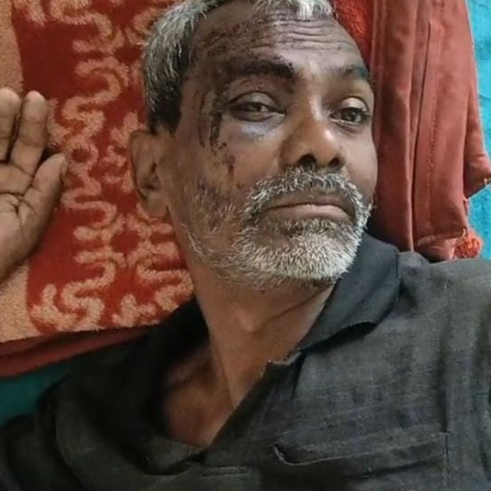 खेत में मवेशी घुसने पर ग्रामीण-चरवाहों में खूनी संघर्ष:एक चरवाहे के कमर में घुसा तीर, दो ग्रामीणों का हाथ-कमर फ्रैक्चर
