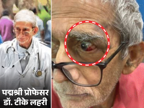 BHU में पद्मश्री डॉ. टीके लाहिड़ी से मारपीट का मामला:प्रो. ओमशंकर ने चश्मदीद से बातचीत का वीडियो जारी किया, बोले- प्रशासन ठीक से करें जांच