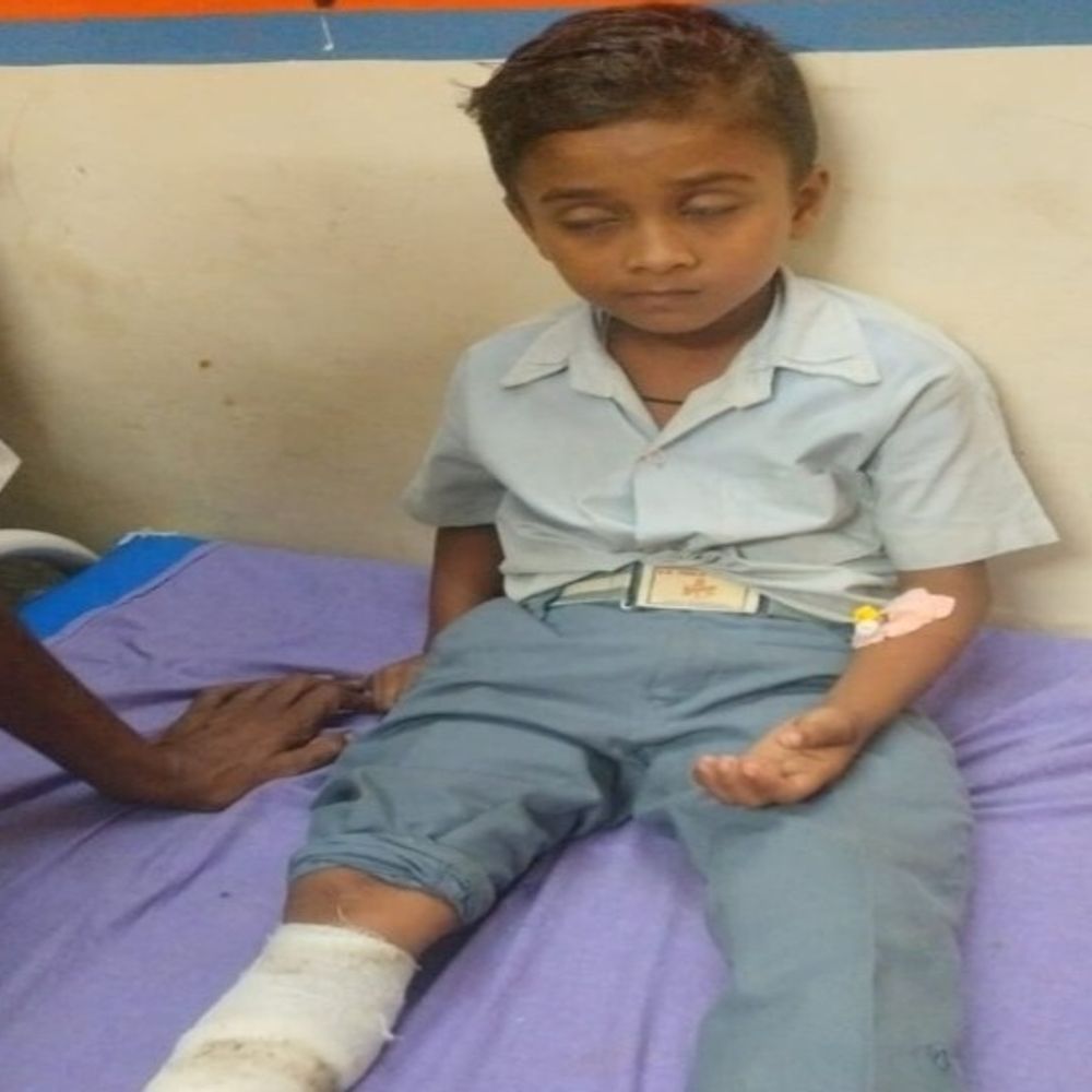 नल के पास सांप ने छात्र को डसा:टीचर तुरंत अस्पताल लाए, डॉक्टर ने लगाई वैक्सीन; हालत खतरे से बाहर