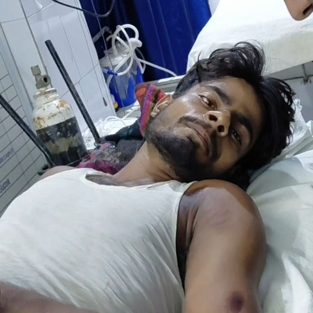 एनएच-31 पर टोटो-बाइक की टक्कर में दो युवक गंभीर घायल:एक को मायागंज अस्पताल रेफर किया, ससुराल जा रहे थे