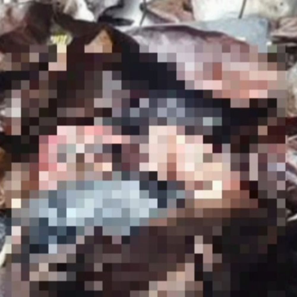 अनूपपुर में कचरे के ढेर में मानव भ्रूण मिला:सफाई कर्मचारी ने देखा, 3-5 माह का होने की आशंका; जिला अस्पताल में कल होगा पीएम
