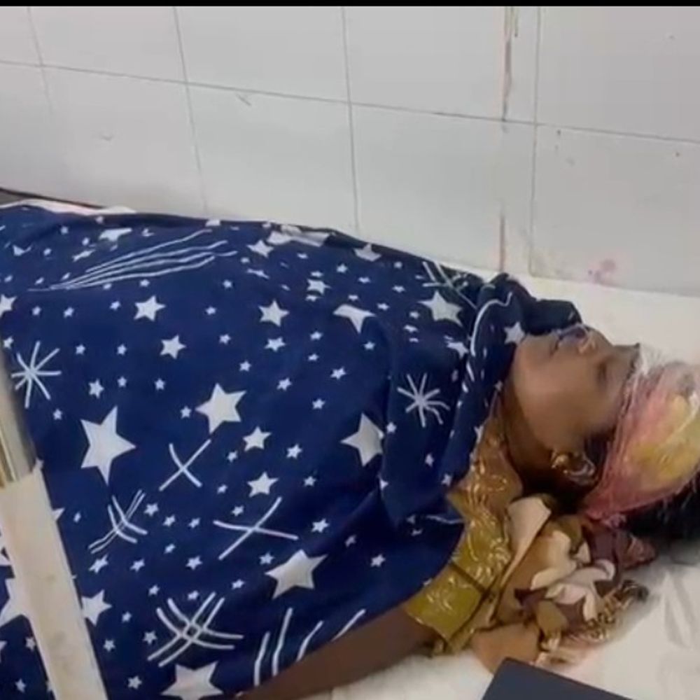 मैहर में पति ने पत्नी पर डंडे से किया हमला:  सिर में लगे 10 टांके, आरोपी फरार, झगड़े का कारण पता नहीं चल पाया – Maihar News