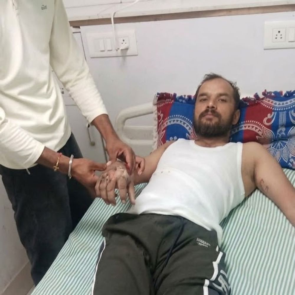 छेहर्टा में बिजली ठीक करते समय सीएचबी कर्मचारी को लगा करंट