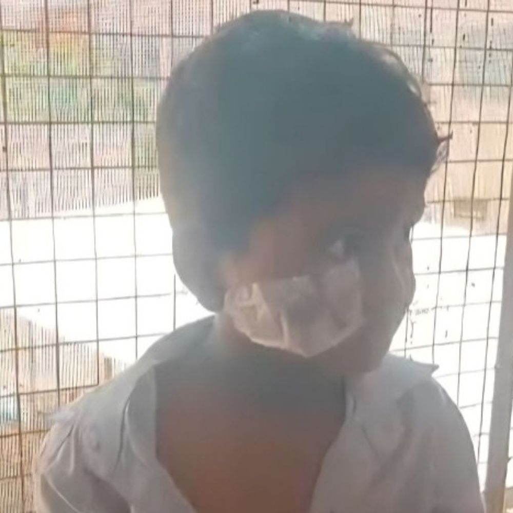 घर के बाहर खेल रहे बच्चे पर कुत्ते का हमला:5 साल के बच्चे के चेहरे को नोचा, शादी समारोह में ननिहाल आया था