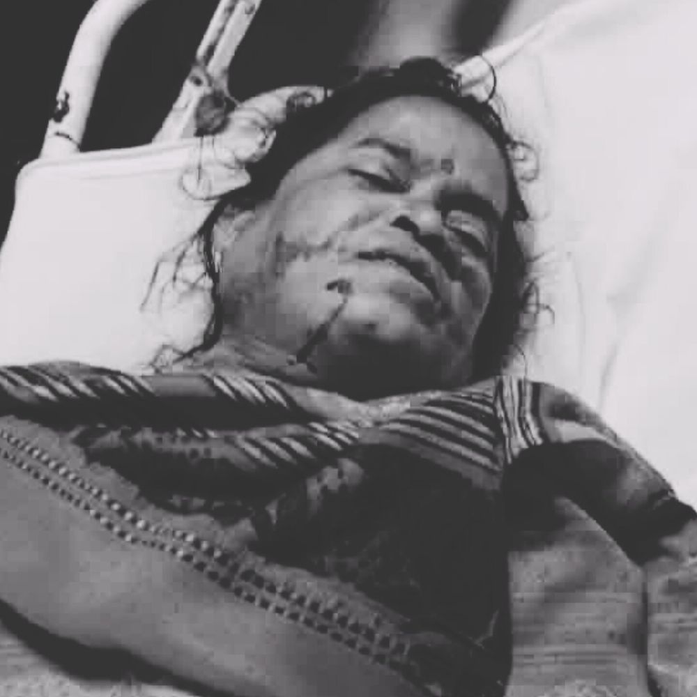 सांप ने डसा, 38 साल की महिला की मौत:शिवपुरी में हाथ-पैर नीले होकर गलने लगे; मेडिकल कॉलेज में दम तोड़ा