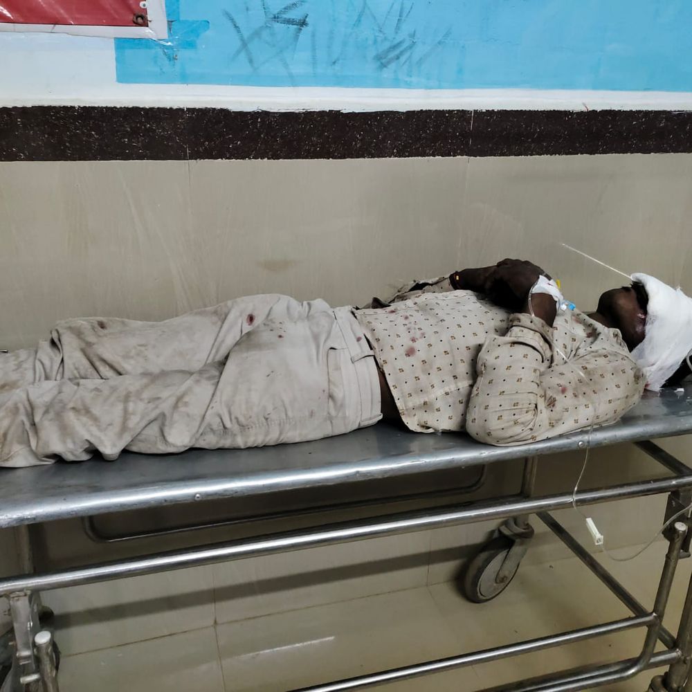 डिवाइडर से टकराई बाइक, उछलकर सड़क पर गिरा युवक:सिर में गंभीर चोट, मनगवां से हनुमना जा रहा था, मऊगंज अस्पताल में भर्ती