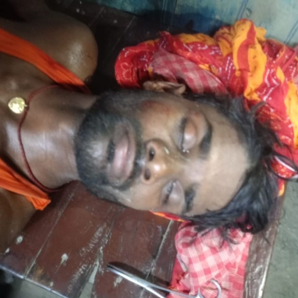 नाला निर्माण के दौरान मजदूर पर हमला,:रेपुरा रामपुर विश्वनाथ गांव का मामला, गंभीर हालत में अस्पताल में भर्ती