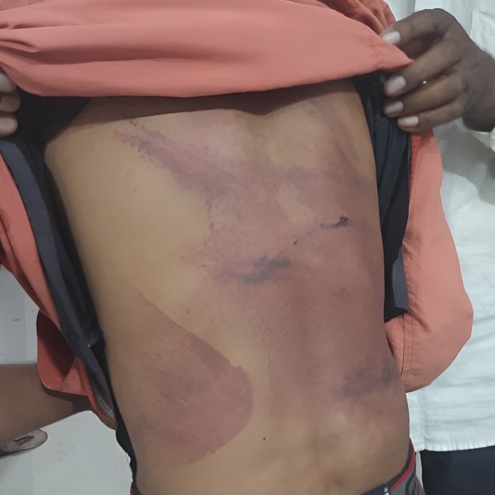 कचरा बीन रहे युवक को चोर समझकर पीटा, अस्पताल में भर्ती