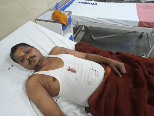 बिलासपुर में युवक पर तब्बल से हमला,अस्पताल में भर्ती:भाई से विवाद में बीच-बचाव करने पहुंचा था, बिजली गुल होते ही पीछे से किया हमला