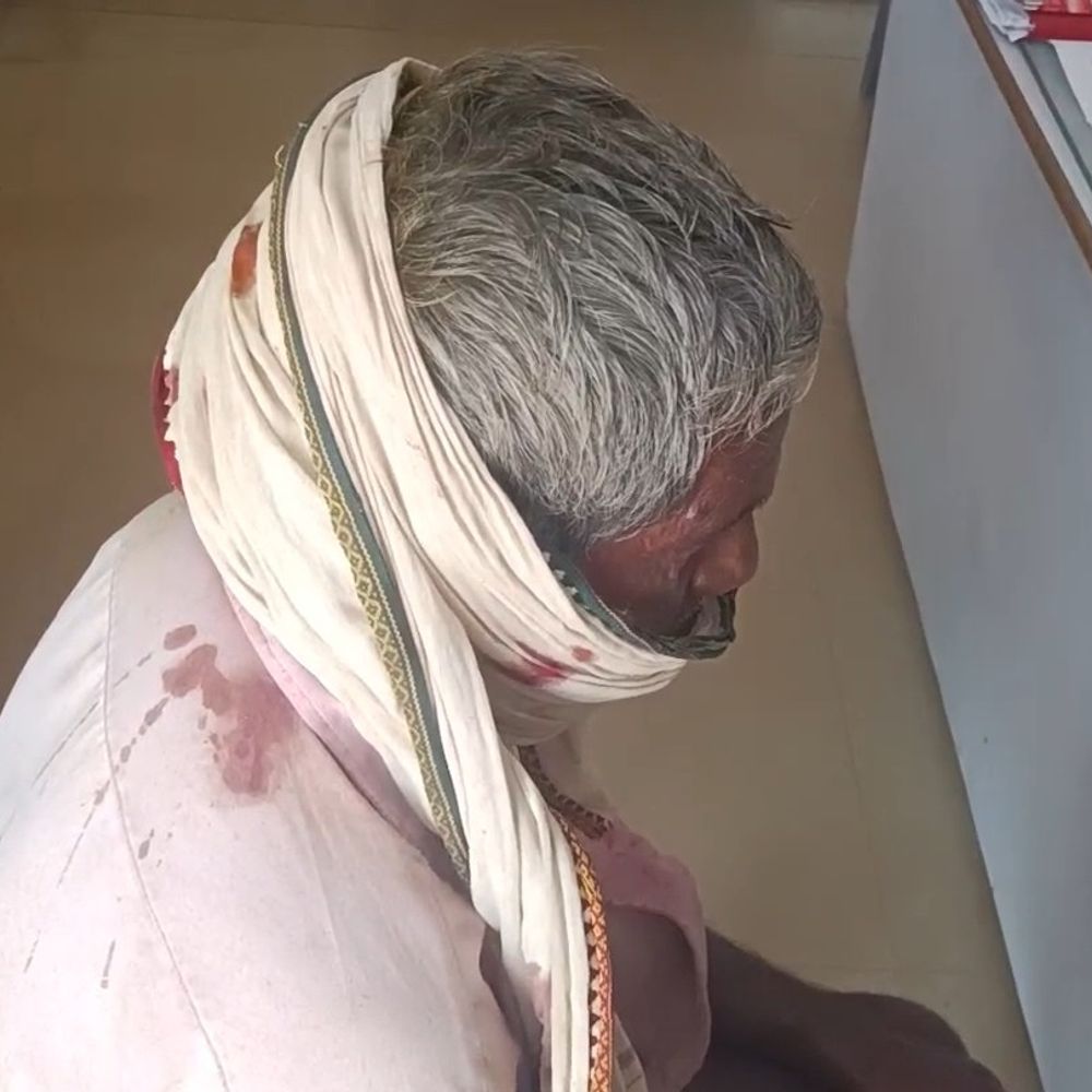 नईगढ़ी- दवा कराने जा रहे बुजुर्ग पर डंडे से हमला:गाली-गलौज के बाद मारपीट, सिर और हाथ में आई गंभीर चोट