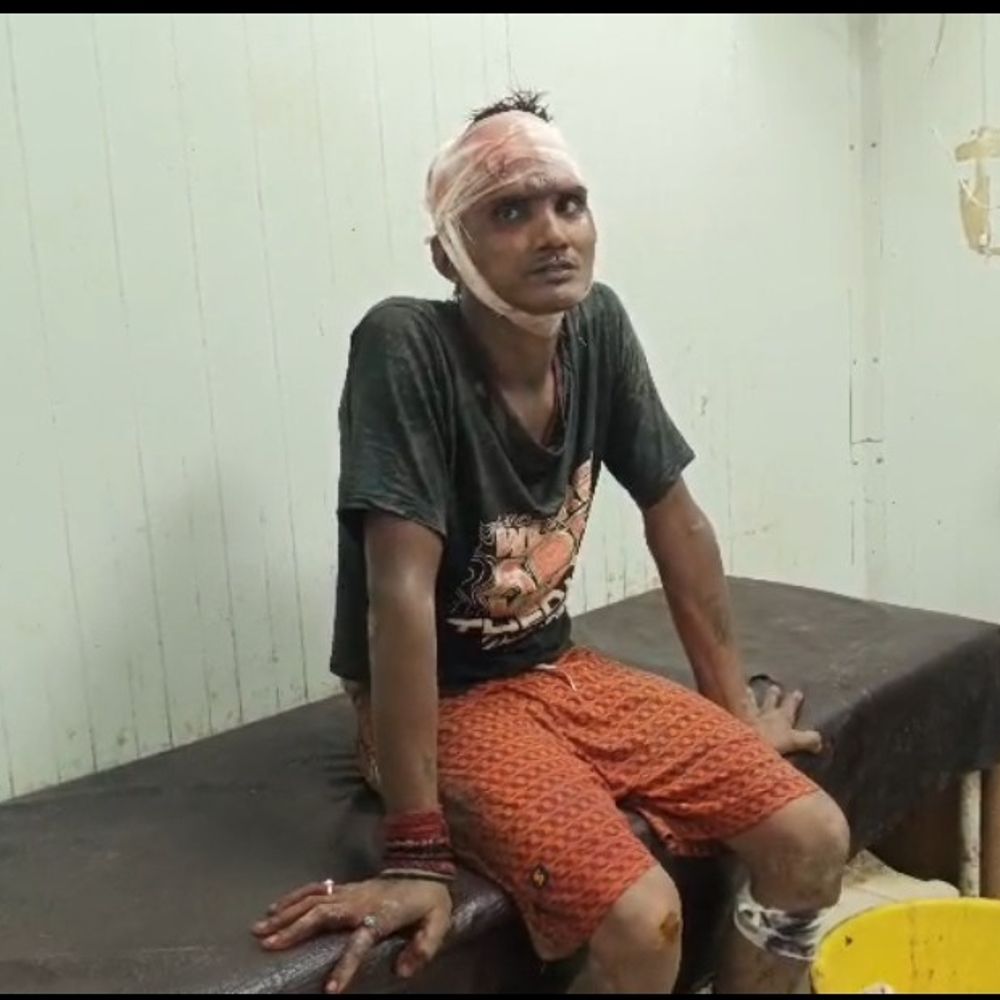 लड़की से पूछा क्या हाल है, युवक की पिटाई:अगरबत्ती लेने दुकान पहुंचा था, लोगों ने पीटा; पुलिस को शिकायत नहीं