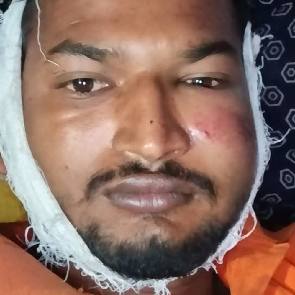 मुरैना में घर के बाहर CCTV कैमरा लगाने पर विवाद:4 दबंगों ने युवक को लाठियों से पीटा, गंभीर हालत में जिला अस्पताल रेफर; पुलिस ने चार पर केस दर्ज किया