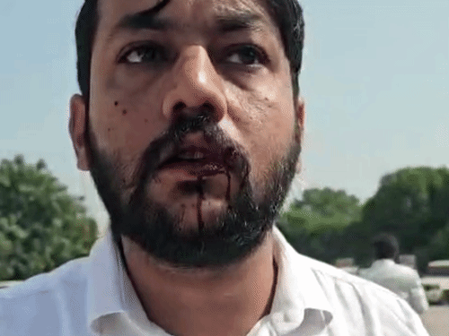 पेशी पर आए हमलावर का वकील पर जानलेवा हमला:पानीपत कोर्ट में वारदात, वर्क सस्पेंड के दौरान गेट पर बैठे थे अधिवक्ता