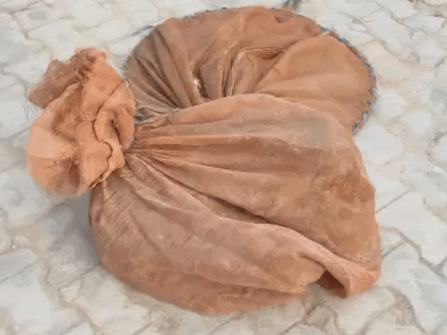 कुत्तों ने किया अटैक, युवक की रेबीज से मौत:20 दिन बाद दम तोड़ा; अब कुत्तों को पकड़कर आबादी से दूर छोड़ रही पालिका टीम