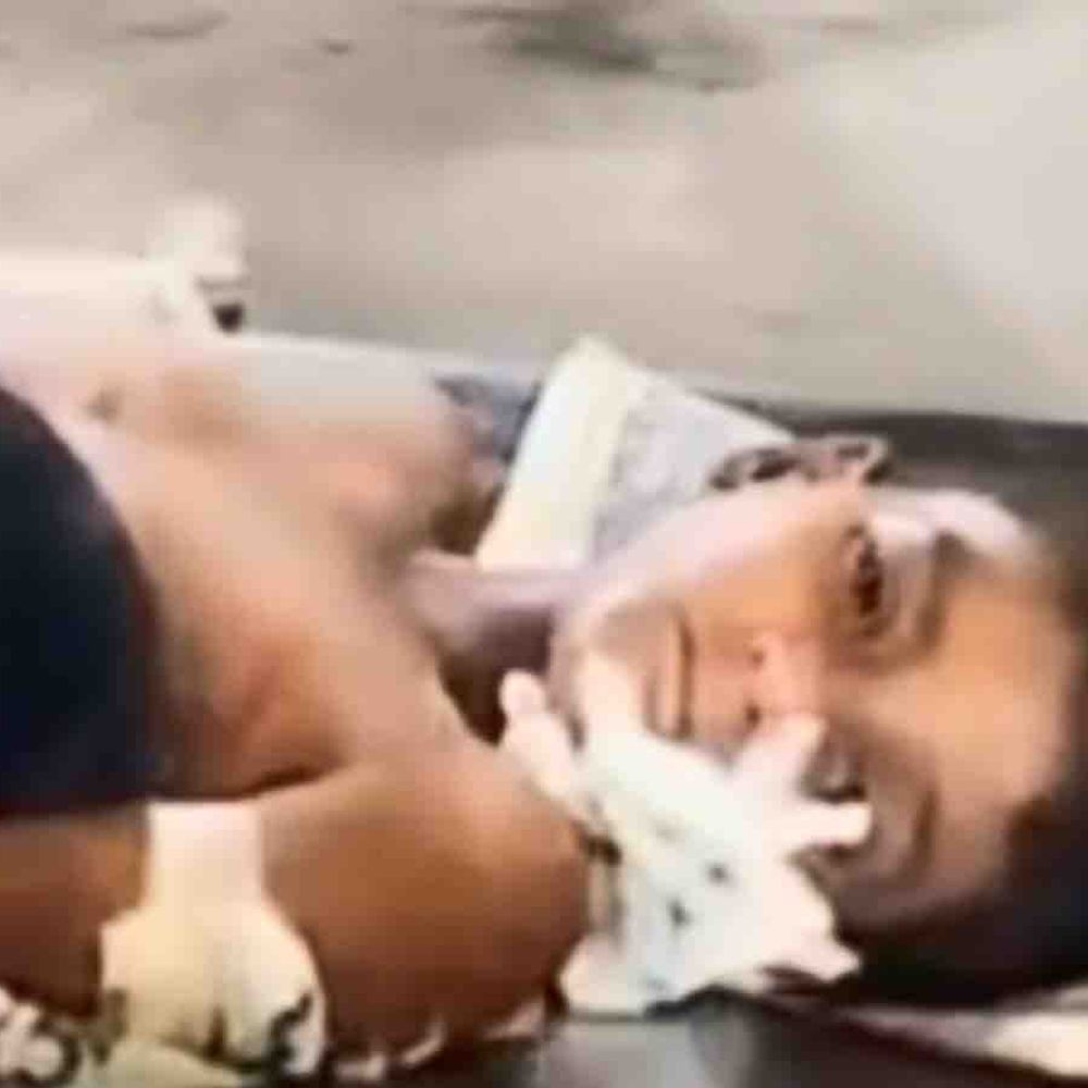 रामपुर में आवारा कुत्तों का हमला:जंगल से घर लौट रहे 7 साल के मासूम को 10 जगह काटा; गंभीर हालत में जिला अस्पताल रेफर