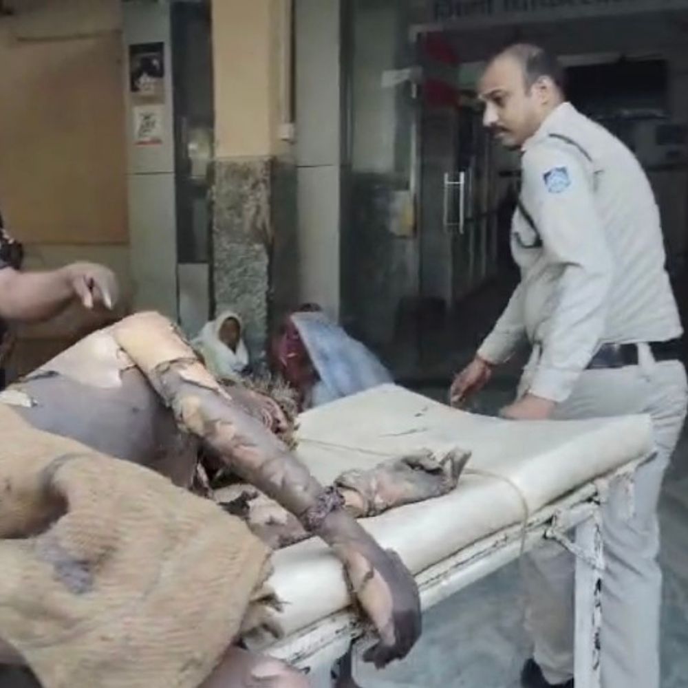 थाने के अंदर आग लगाने वाले शख्स की मौत:परिजनों ने पुलिस पर जलाने का लगाया आरोप; एसपी बोले-मामले की निष्पक्ष जांच करेंगे