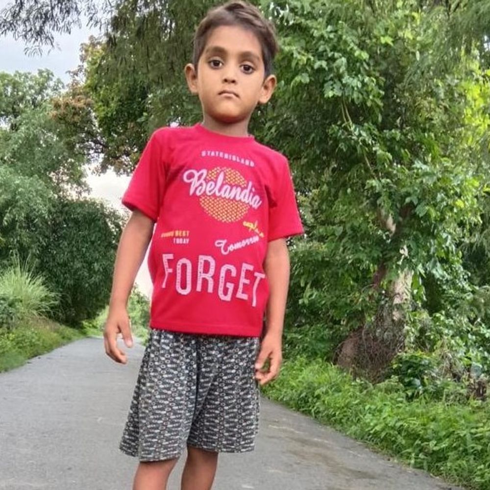 प्रतापगढ़ में कुत्ते के काटने से 7वर्षीय बच्चे की मौत:लखनऊ मेडिकल कॉलेज में इलाज के दौरान तोड़ा दम, परिवार में मातम