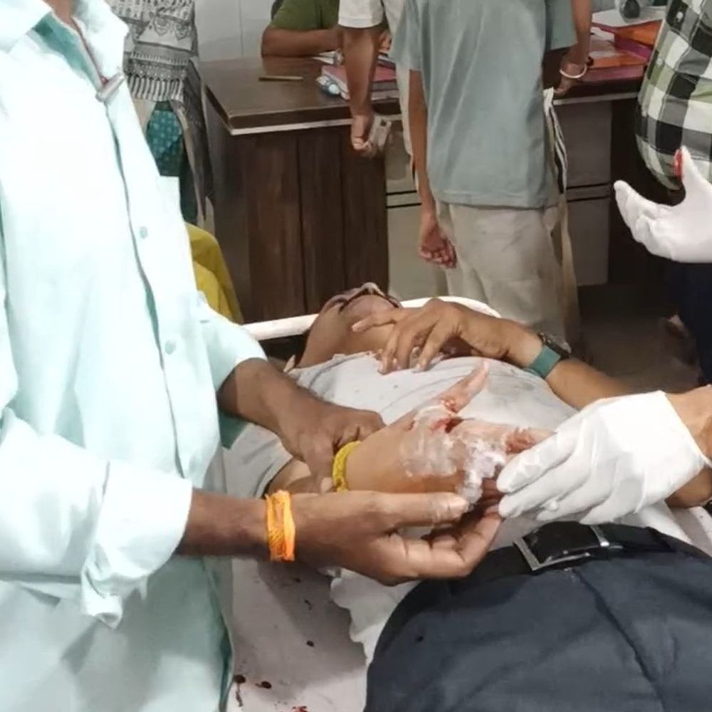 कानपुर में नगर निगम ठेकेदार पर गड़ासे से हमला:पीछे से सिर पर किए 2 वार, हाथ पर भी लगी चोट; आरोपी फरार