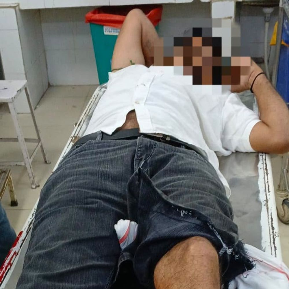 हिसार में पुलिस और बदमाशों के बीच मुठभेड़:एक बदमाश के पैर में लगी गोली, साथी गिरफ्तार; विनोद पानू हत्याकांड में थे वांछित