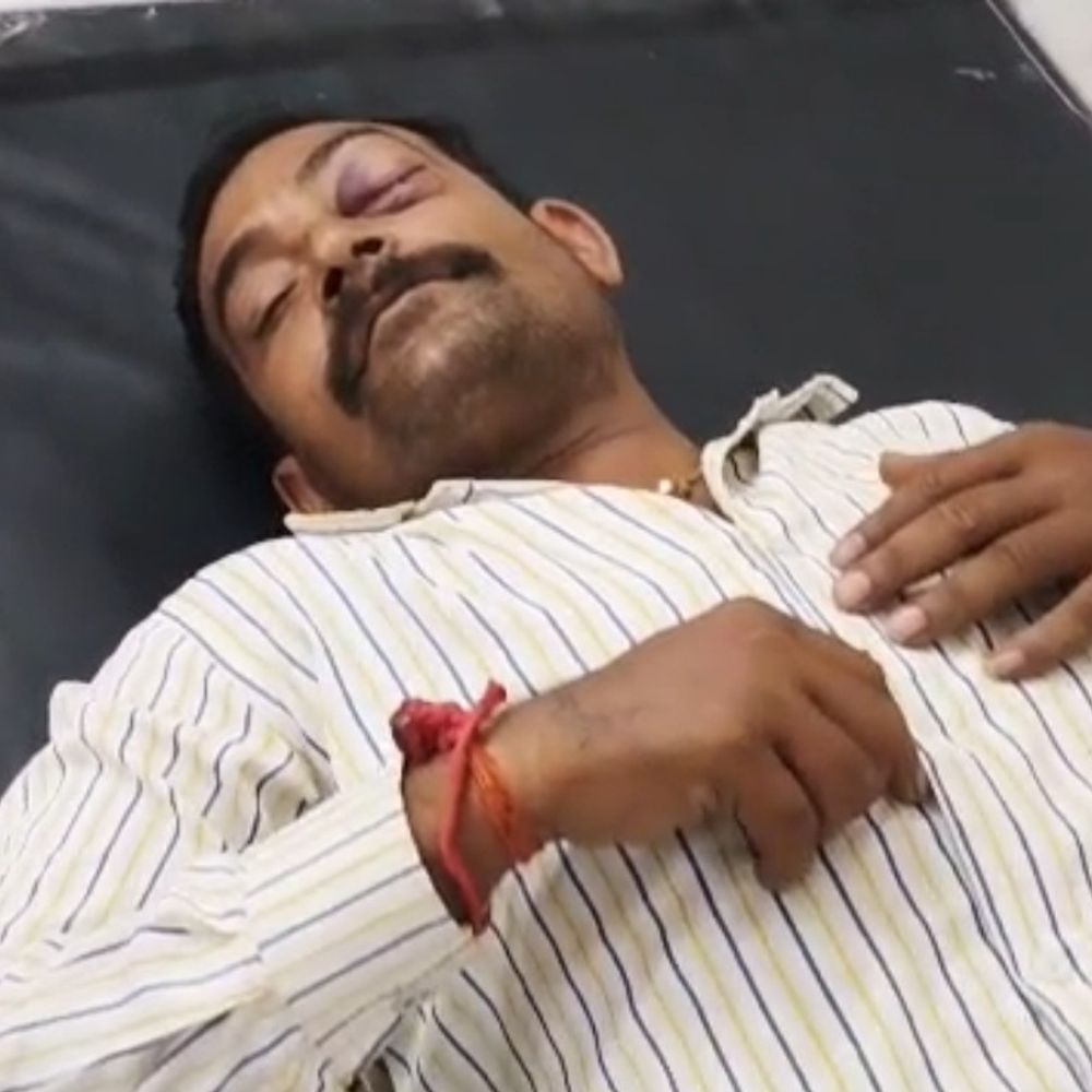 मैहर में वेयरहाउस के गार्ड को तीन युवकों ने पीटा:डंडे मारे, आंख, सिर और पैर में चोट; सहकर्मी को खून से लथपथ मिला