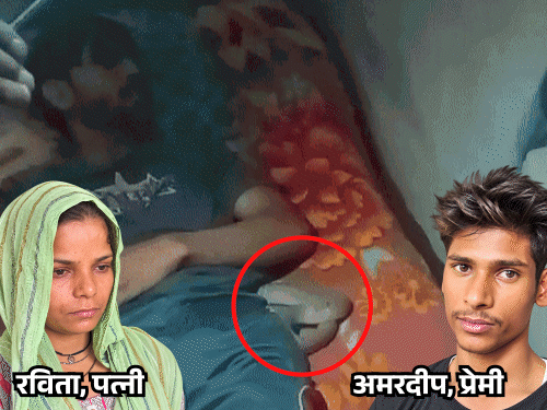 सांप से डसाने वाली हत्यारी पत्नी की लव स्टोरी:दाल-चावल खिलाकर अमरदीप के करीब आई, वीडियो कॉल पर चोट दिखाकर बोली- पति बेरहम है