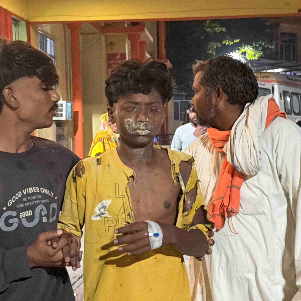 रामपुर में गंधक-पोटाश फटने से युवक झुलसा:सोमवार रात हथौड़ी पटकने के दौरान हादसा, मेरठ रेफर