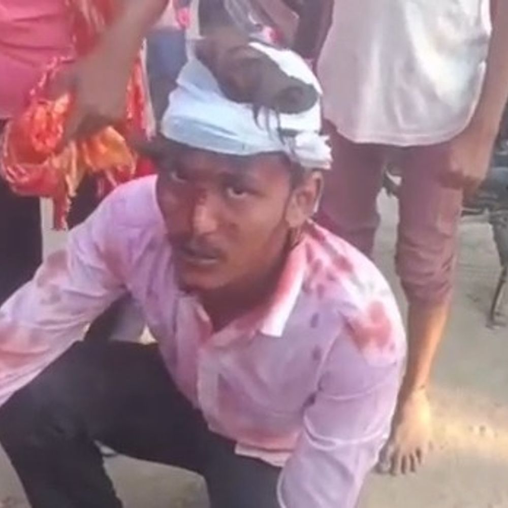 गोंडा में साइड मांगने पर दो गुटों में मारपीट:सड़क पर चले लात घूंसे, पांच लोग गंभीर रूप से घायल
