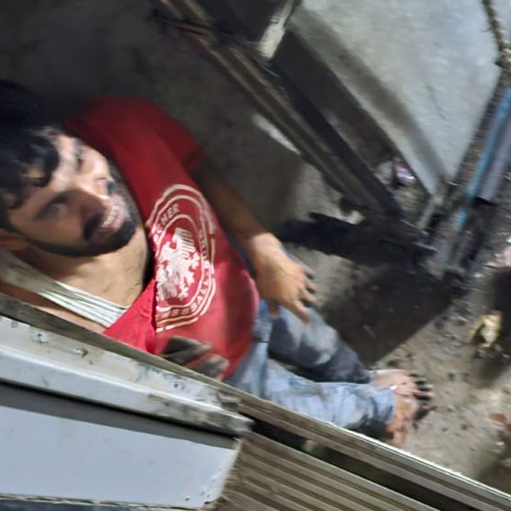 ग्रेटर नोएडा में लिफ्ट गिरने से डिलीवरी बॉय घायल:पैर में फ्रैक्चर, ऑपरेशन कर रॉड डाली, लोग बोले- शिकायतों पर नहीं दिया गया ध्यान
