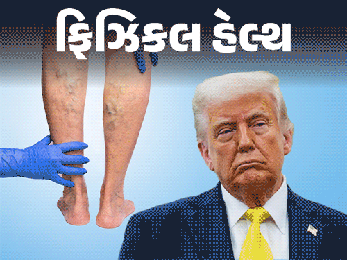 ડોનાલ્ડ ટ્રમ્પ નર્વ્સની ગંભીર બીમારીથી પીડિત!:ભારતમાં પણ દર ત્રણમાંથી એક વ્યક્તિને આ સમસ્યા; CVI શું છે? પગના સોજાને અવગણશો નહીં; બચવા માટેની 10 ટિપ્સ