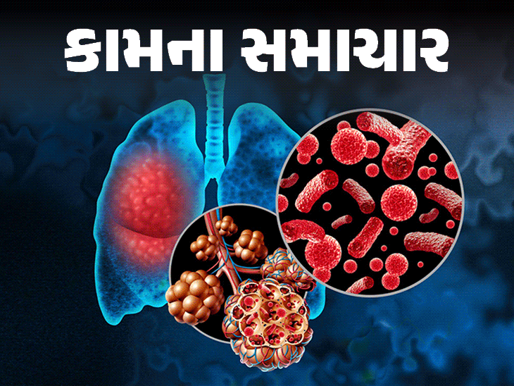 ચોમાસામાં ન્યુમોનિયાનું જોખમ વધુ:આ 7 લક્ષણો અવગણશો તો ચેપના ભરડામાં આવી જશો, બચવા માટે 11 ટિપ્સ અપનાવો
