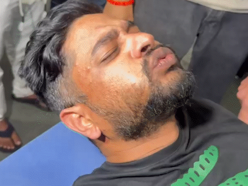 સુરતના કુખ્યાત સલમાન લસ્સી પર ક્રાઈમ બ્રાંચનું ફાયરિંગ: પગમાં ગોળી વાગી, નવસારીના ડાભેલમાં પોલીસનું ઓપરેશન.