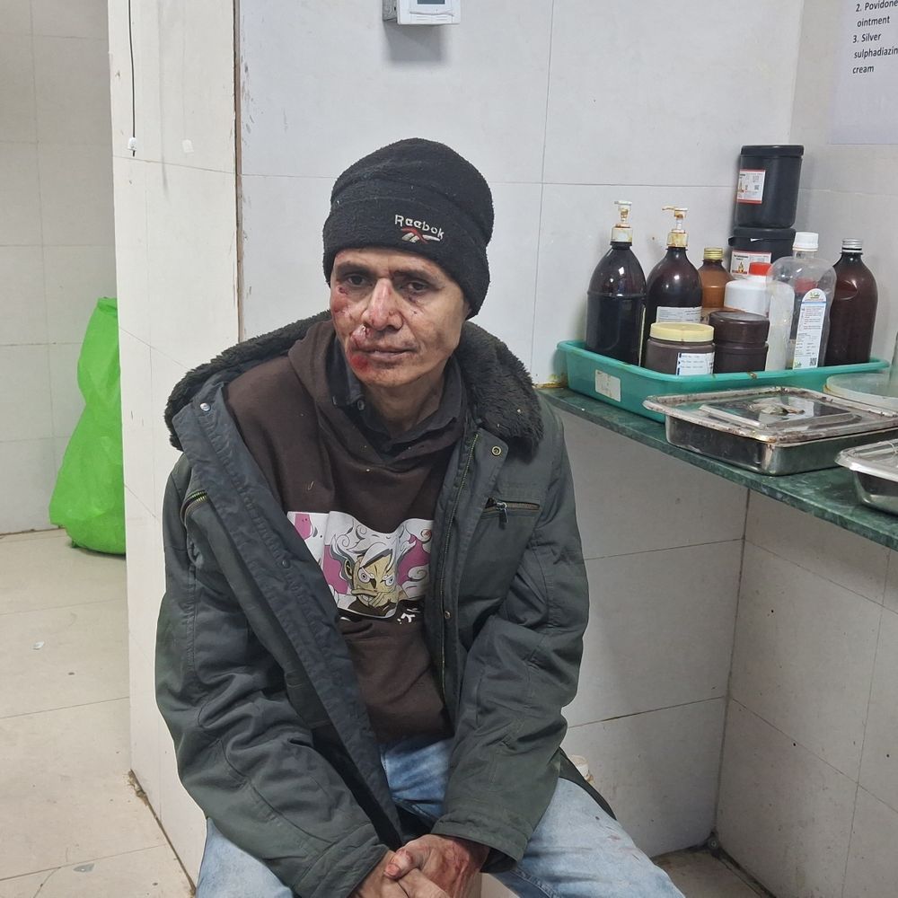 વલસાડના અતુલ હાઇવે પર બાઇક સ્લિપ થતા પ્રોઢ ઈજાગ્રસ્ત, સિવિલ હોસ્પિટલમાં સારવાર હેઠળ.